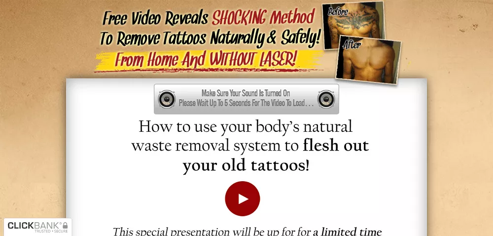 Laserless Tattoo Removal Coupon Code